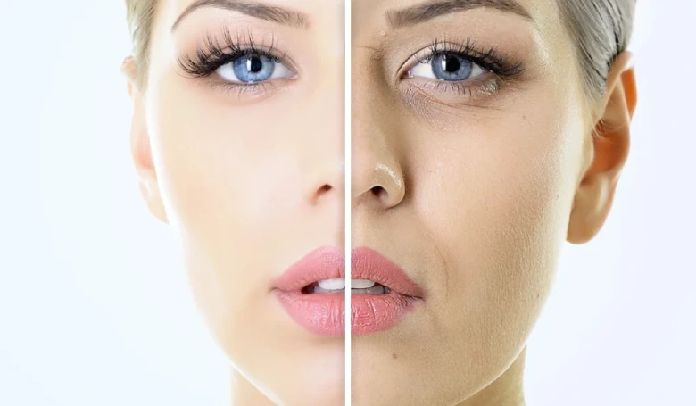 قبل و بعد مزوژل