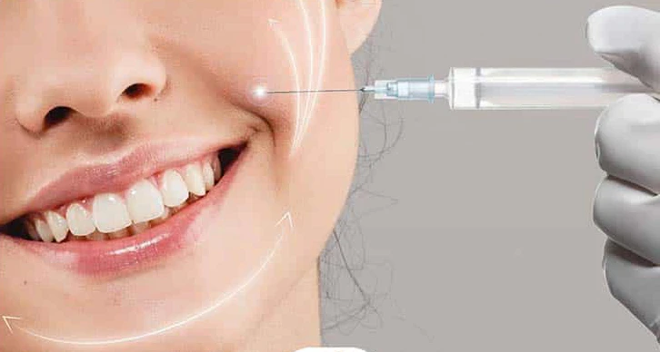 قیمت فیلر خط خنده