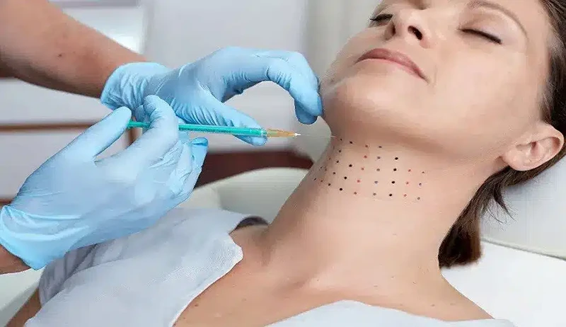 مزو غبغب چیست
