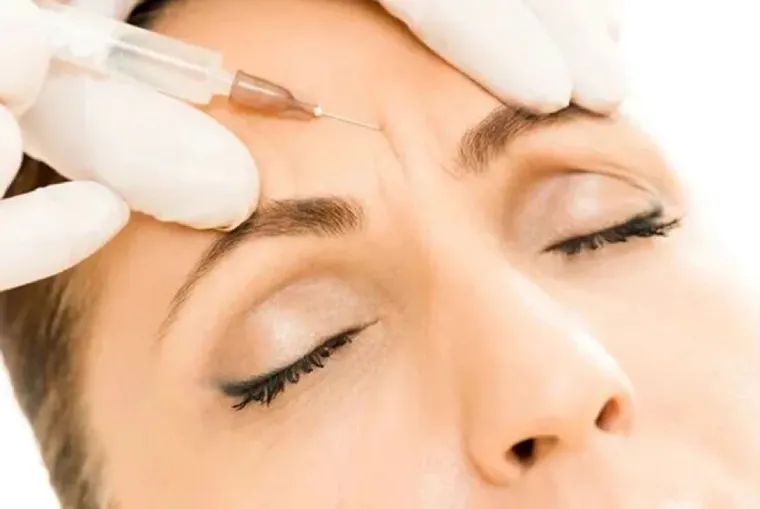 کاربرد بوتاکس خط اخم در جوانسازی صورت